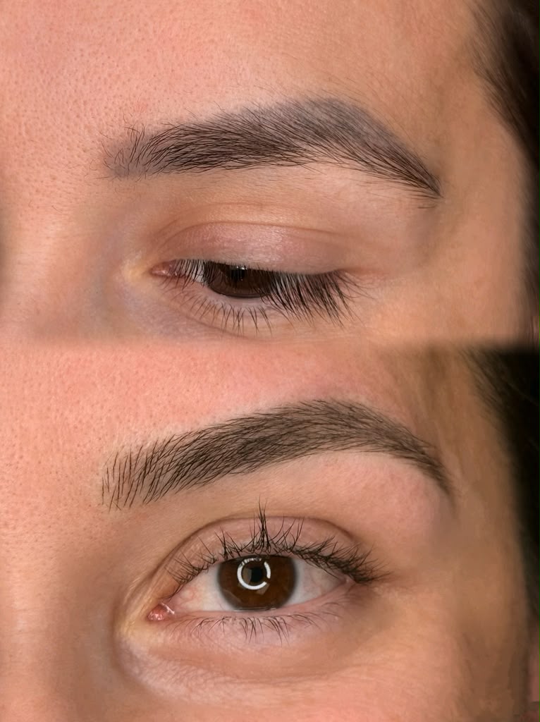 Despigmentação + micro nova - Mabella Beauty, Milford MA
