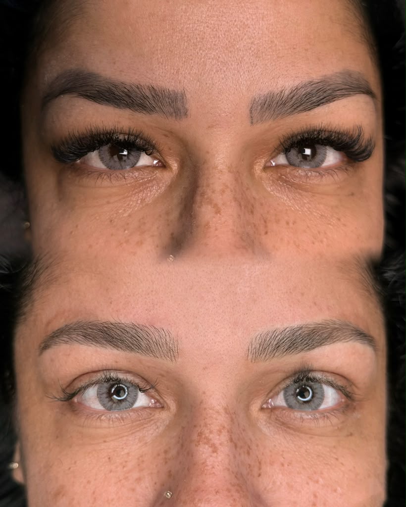 Despigmentação + micro nova - Mabella Beauty, Milford MA
